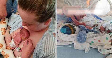 born lucky888 login|After this baby was born at 27 weeks, a test that .